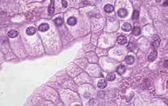 Microscopio binocular 1000x, objetivos IOS E-PLAN B-292PLi-1554